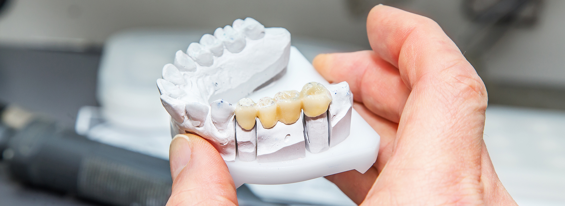 Durham Dental Studio | Sports Mouthguards, Dental Fillings and Dentures